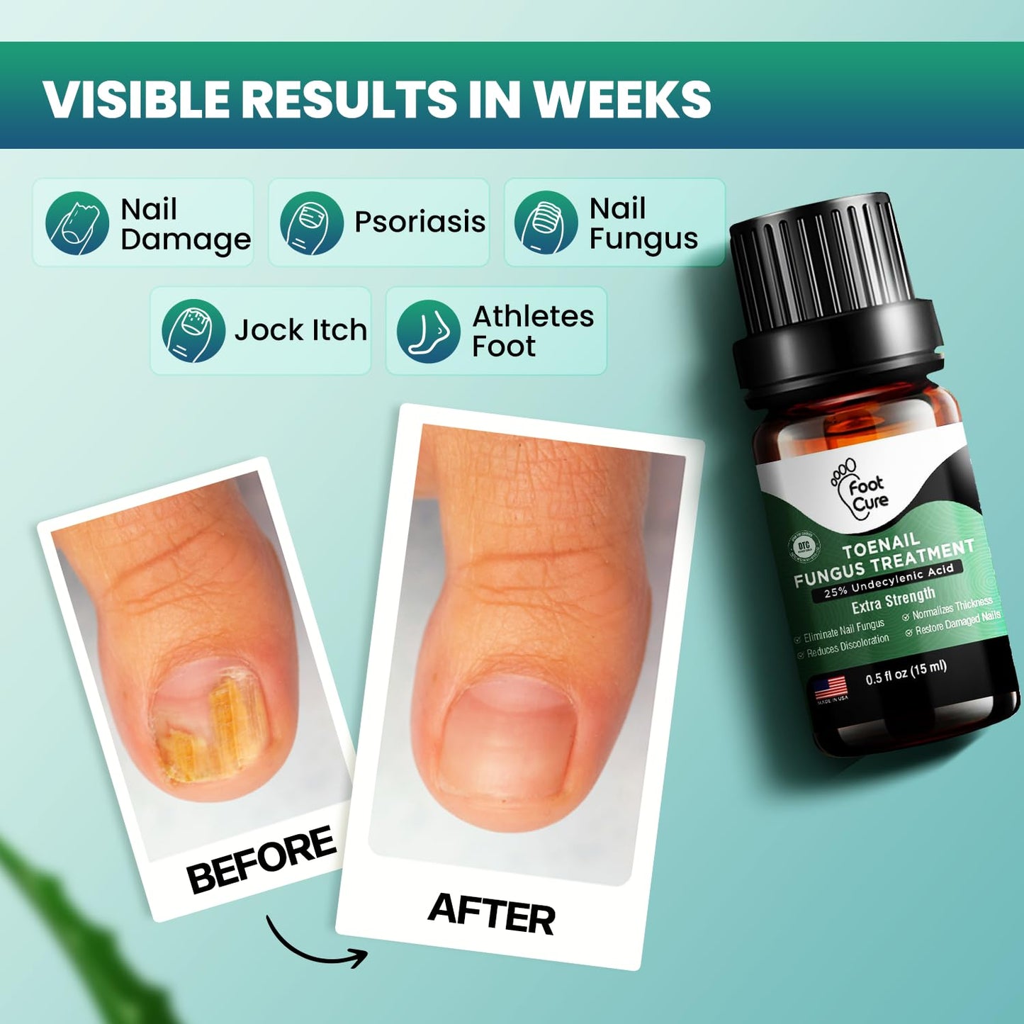 Foot Cure Tratamiento de hongos en las uñas de los pies extra fuerte 15ml